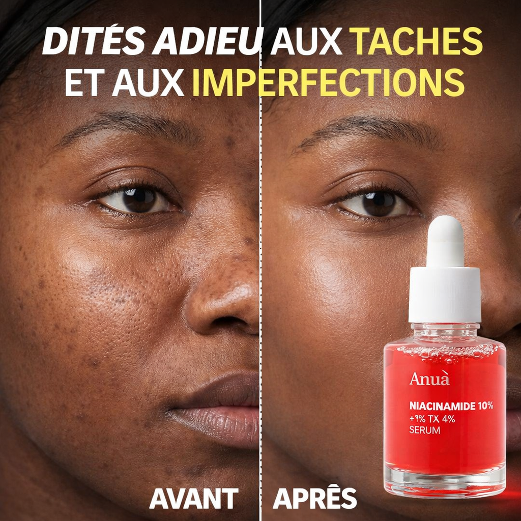 Anua+ à la niacinamide 10% et TXA 4%